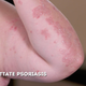 Image for article titled Dr. Pimple Popper Treats Someone With a Tennis Ball-Sized Lump in His Neck